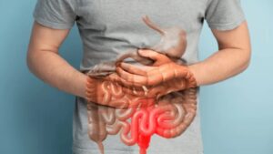 Understanding Inflammatory Bowel Disease (IBD) and Colitis: Symptoms, Treatment, and Lifestyle Tips