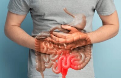 Understanding Inflammatory Bowel Disease (IBD) and Colitis: Symptoms, Treatment, and Lifestyle Tips